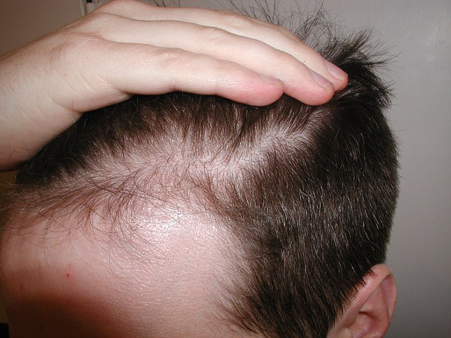 Best Effective Methods to Maintain Men's Hair Healthy