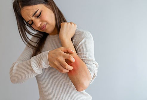 Everyone should know these causes of itching and these effective ways to get rid of it